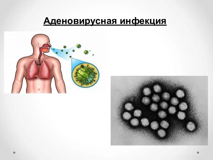 Аденовирусная инфекция