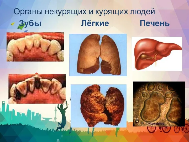 Органы некурящих и курящих людей Зубы Лёгкие Печень