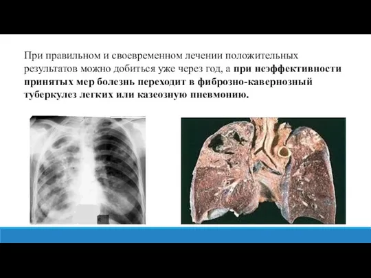 При правильном и своевременном лечении положительных результатов можно добиться уже через год,