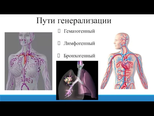 Пути генерализации Гематогенный Лимфогенный Бронхогенный