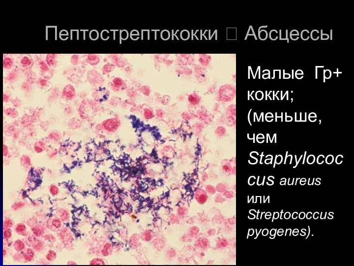 http://info.fujita-hu.ac.jp/~tsutsumi/case/case107.htm Малые Гр+ кокки; (меньше, чем Staphylococcus aureus или Streptococcus pyogenes). Пептострептококки ? Абсцессы