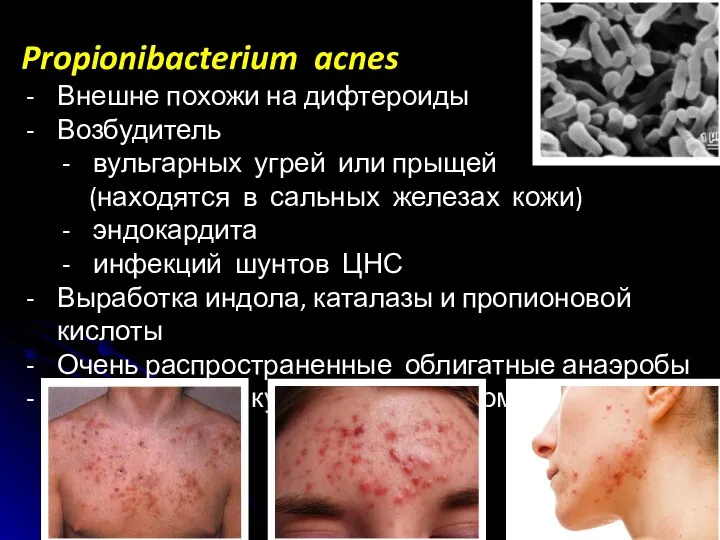 Propionibacterium acnes Внешне похожи на дифтероиды Возбудитель вульгарных угрей или прыщей (находятся