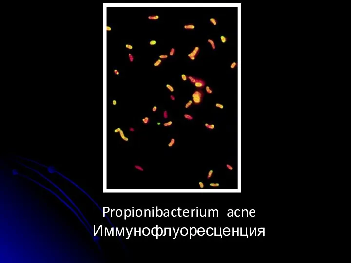 Propionibacterium acne Иммунофлуоресценция