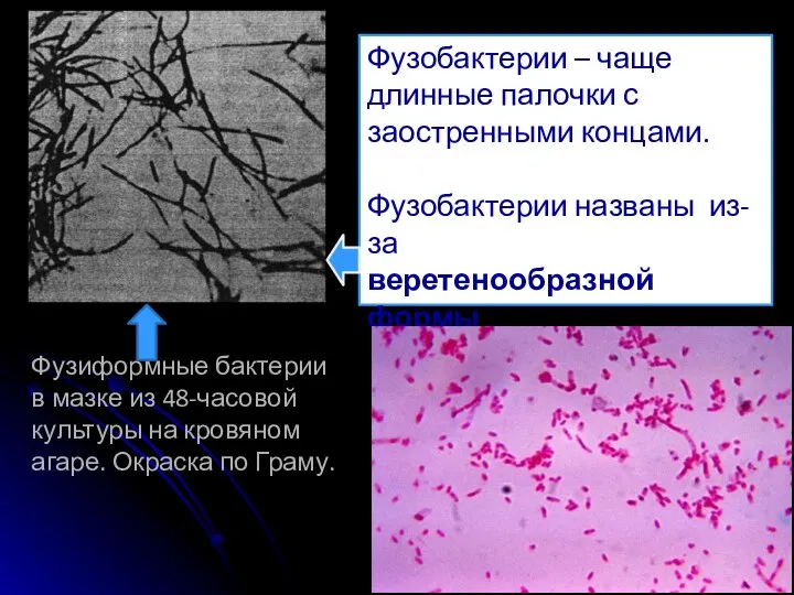 Фузиформные бактерии в мазке из 48-часовой культуры на кровяном агаре. Окраска по