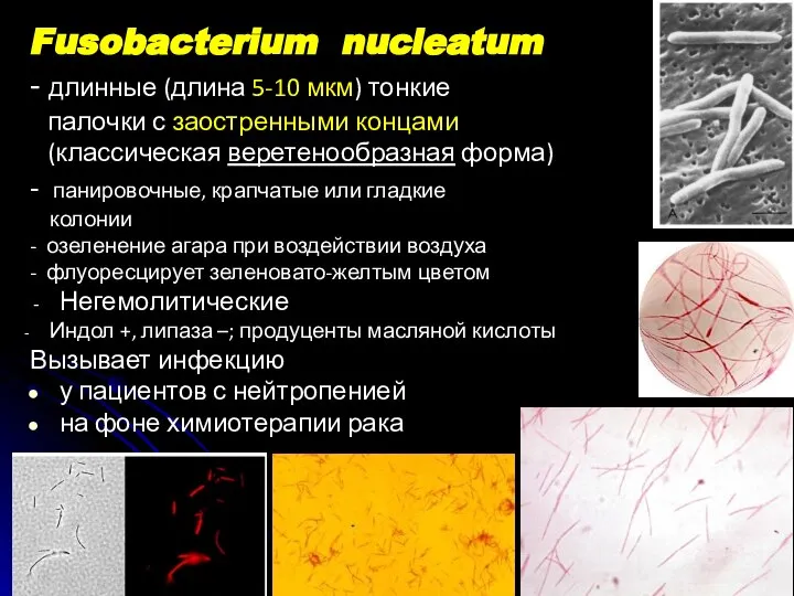 Fusobacterium nucleatum - длинные (длина 5-10 мкм) тонкие палочки с заостренными концами