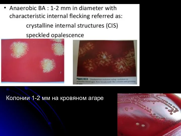 Колонии 1-2 мм на кровяном агаре