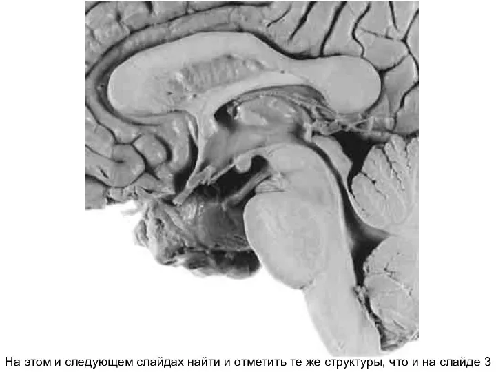 На этом и следующем слайдах найти и отметить те же структуры, что и на слайде 3