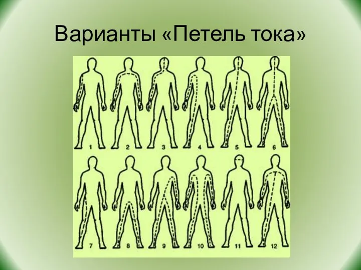 Варианты «Петель тока»