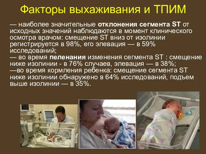 Факторы выхаживания и ТПИМ — наиболее значительные отклонения сегмента ST от исходных