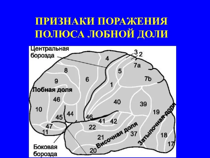 ПРИЗНАКИ ПОРАЖЕНИЯ ПОЛЮСА ЛОБНОЙ ДОЛИ