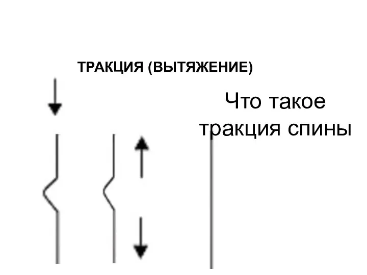 Что такое тракция спины ТРАКЦИЯ (ВЫТЯЖЕНИЕ)