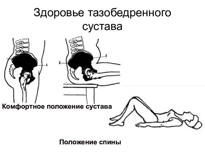 Здоровье тазобедренного сустава Комфортное положение сустава Положение спины Комфортное положение сустава Положение спины