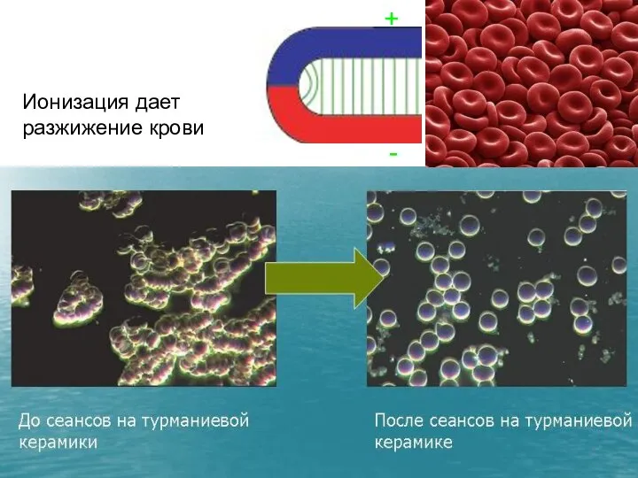 Ионизация дает разжижение крови + -