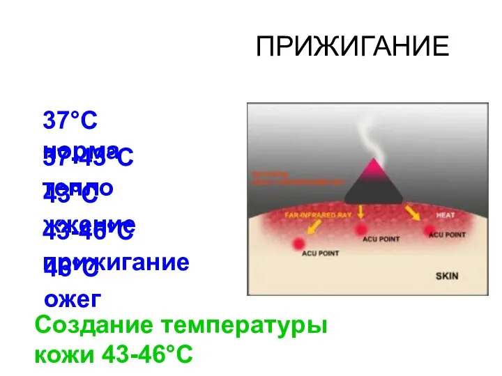 ПРИЖИГАНИЕ 37°С норма 37-43°С тепло 43°С жжение 43-46°С прижигание 46°С ожег Создание температуры кожи 43-46°С