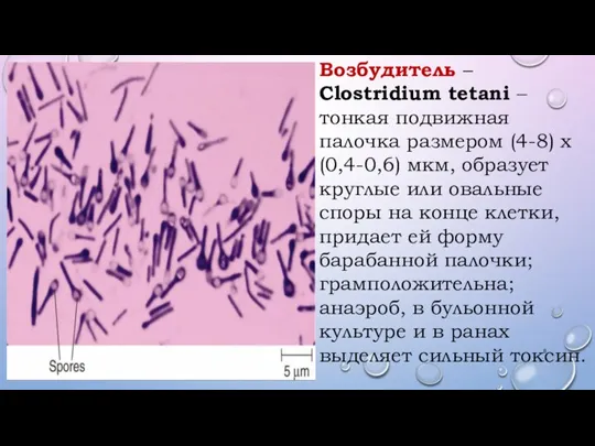 Возбудитель – Clostridium tetani – тонкая подвижная палочка размером (4-8) х (0,4-0,6)