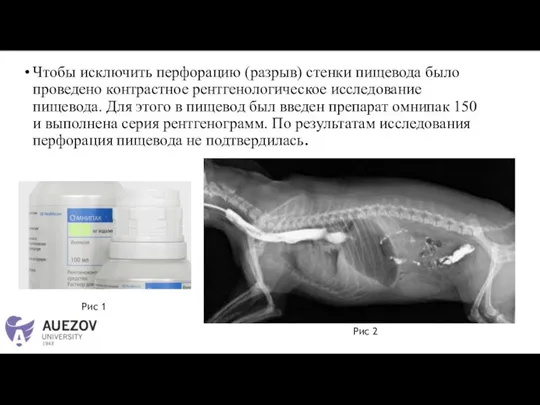 Чтобы исключить перфорацию (разрыв) стенки пищевода было проведено контрастное рентгенологическое исследование пищевода.