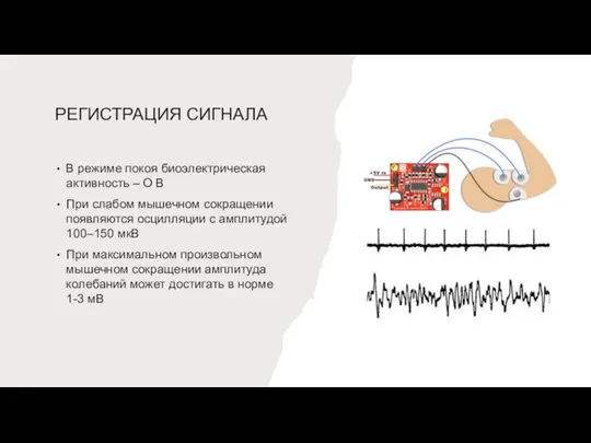 РЕГИСТРАЦИЯ СИГНАЛА В режиме покоя биоэлектрическая активность – О В При слабом