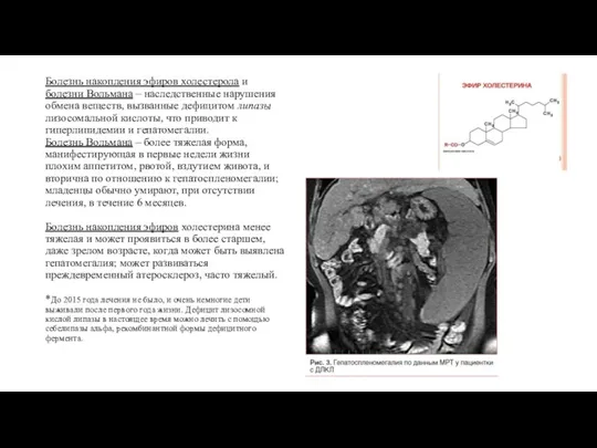 Болезнь накопления эфиров холестерола и болезни Вольмана – наследственные нарушения обмена веществ,