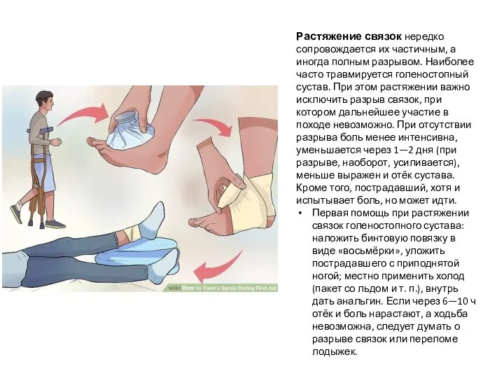 Растяжение связок нередко сопровождается их частичным, а иногда полным разрывом. Наиболее часто