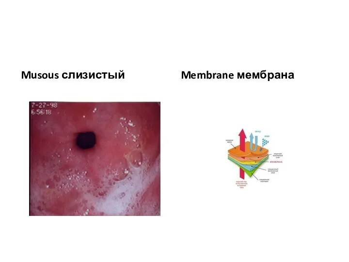 Musous слизистый Membrane мембрана