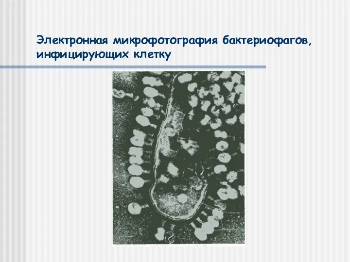 Электронная микрофотография бактериофагов, инфицирующих клетку