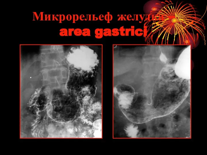 Микрорельеф желудка – area gastrici