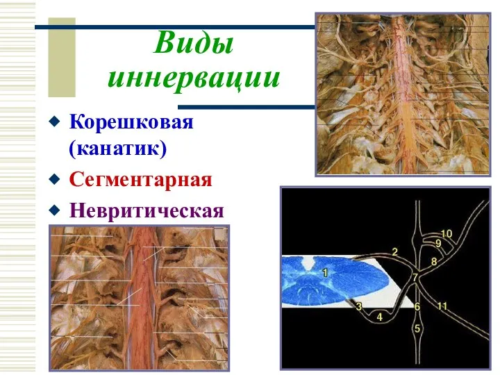 Виды иннервации Корешковая (канатик) Сегментарная Невритическая