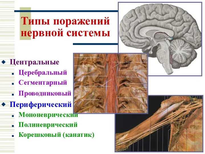 Типы поражений нервной системы Центральные Церебральный Сегментарный Проводниковый Периферический Мононеврический Полиневрический Корешковый (канатик)