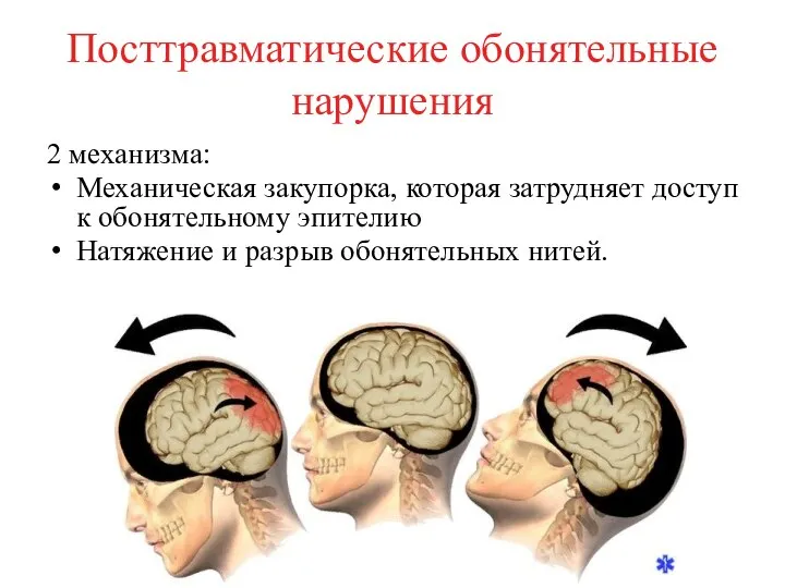 Посттравматические обонятельные нарушения 2 механизма: Механическая закупорка, которая затрудняет доступ к обонятельному