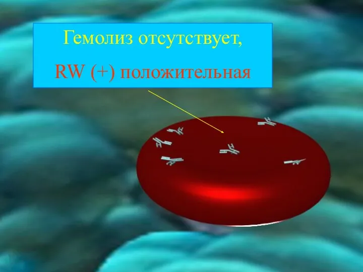 Гемолиз отсутствует, RW (+) положительная