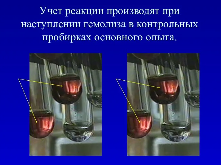 Учет реакции производят при наступлении гемолиза в контрольных пробирках основного опыта.