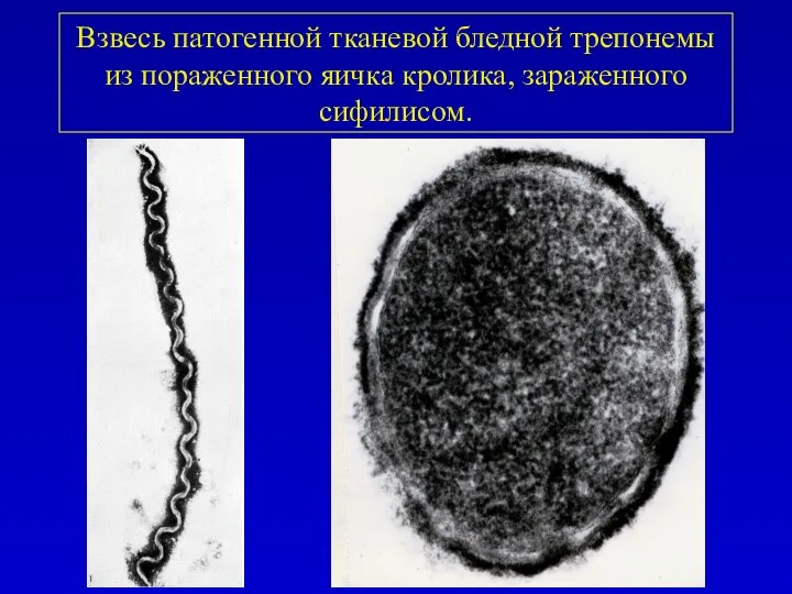 Взвесь патогенной тканевой бледной трепонемы из пораженного яичка кролика, зараженного сифилисом.