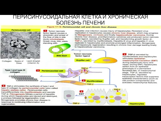 ПЕРИСИНУСОИДАЛЬНАЯ КЛЕТКА И ХРОНИЧЕСКАЯ БОЛЕЗНЬ ПЕЧЕНИ