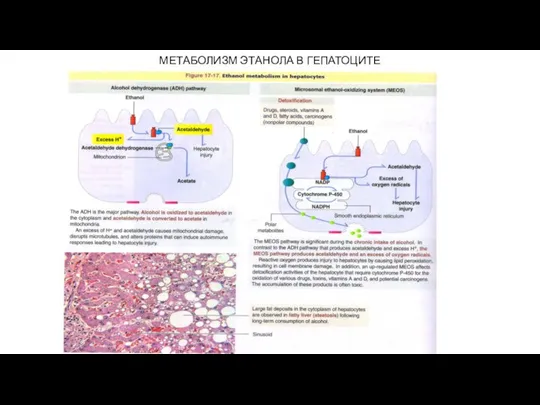 МЕТАБОЛИЗМ ЭТАНОЛА В ГЕПАТОЦИТЕ