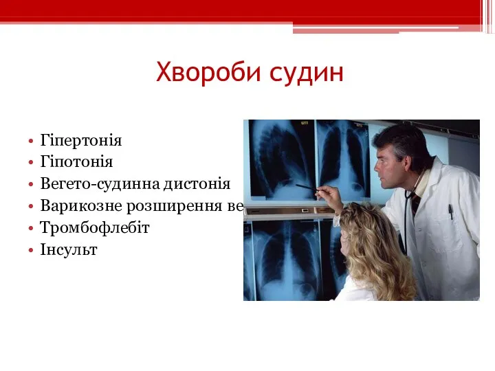 Хвороби судин Гіпертонія Гіпотонія Вегето-судинна дистонія Варикозне розширення вен Тромбофлебіт Інсульт