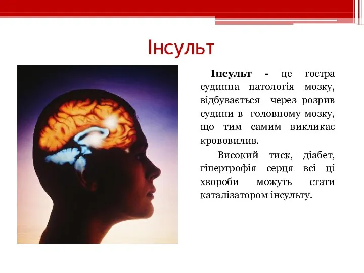 Інсульт Інсульт - це гостра судинна патологія мозку, відбувається через розрив судини