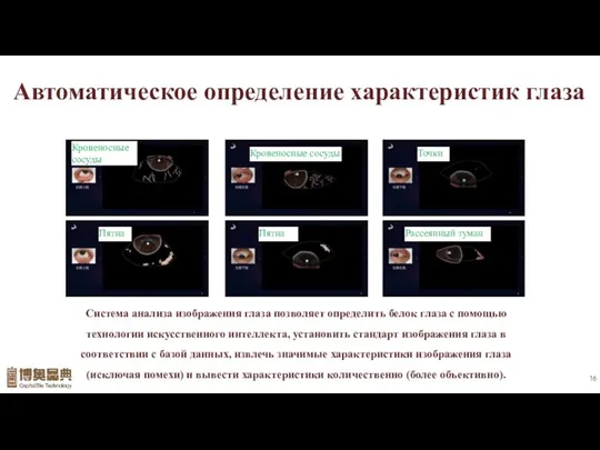 Автоматическое определение характеристик глаза Система анализа изображения глаза позволяет определить белок глаза