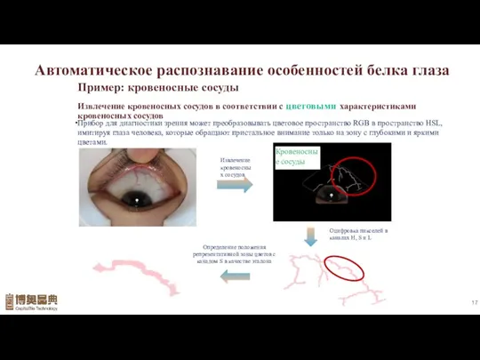 Прибор для диагностики зрения может преобразовывать цветовое пространство RGB в пространство HSL,