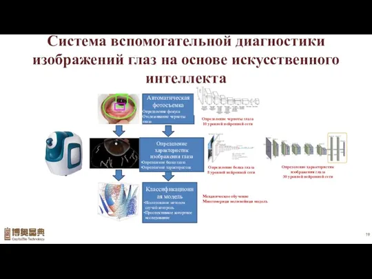 Система вспомогательной диагностики изображений глаз на основе искусственного интеллекта