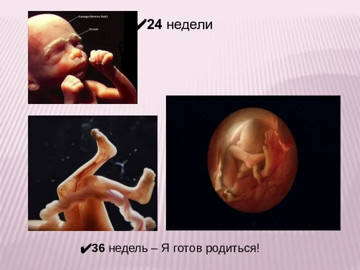 36 недель – Я готов родиться! 24 недели