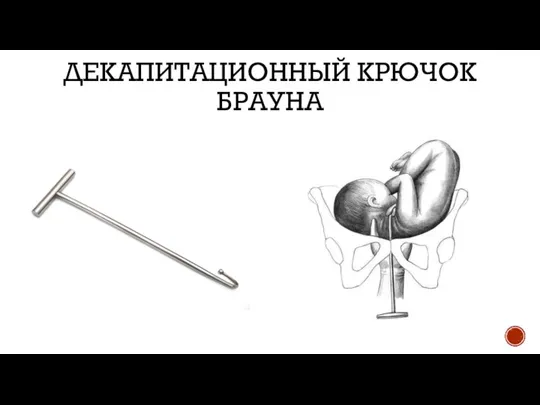 ДЕКАПИТАЦИОННЫЙ КРЮЧОК БРАУНА