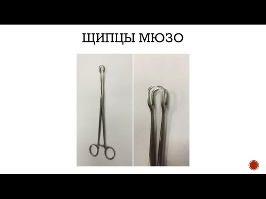 ЩИПЦЫ МЮЗО