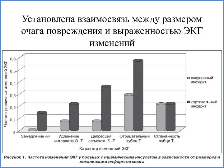 Установлена взаимосвязь между размером очага повреждения и выраженностью ЭКГ изменений