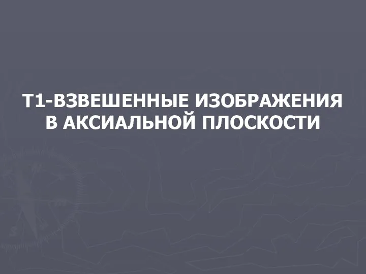 Т1-ВЗВЕШЕННЫЕ ИЗОБРАЖЕНИЯ В АКСИАЛЬНОЙ ПЛОСКОСТИ