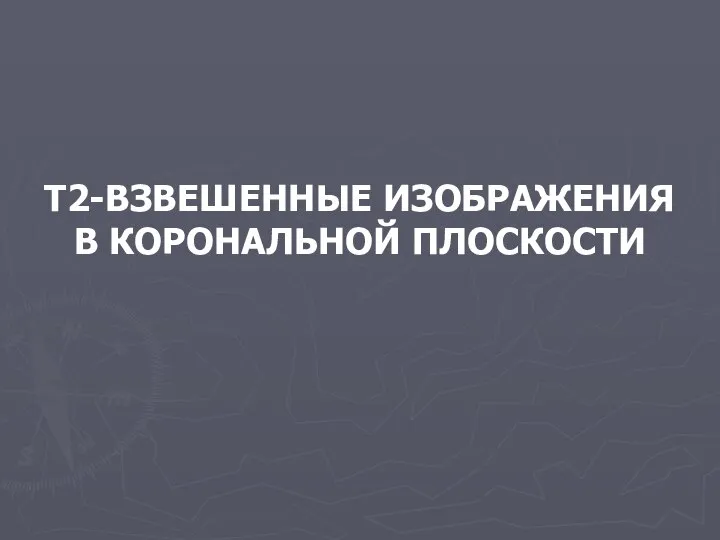 Т2-ВЗВЕШЕННЫЕ ИЗОБРАЖЕНИЯ В КОРОНАЛЬНОЙ ПЛОСКОСТИ