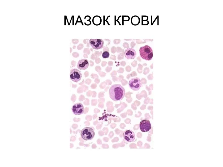 МАЗОК КРОВИ