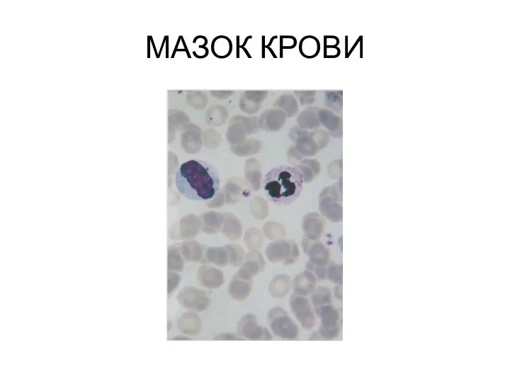 МАЗОК КРОВИ