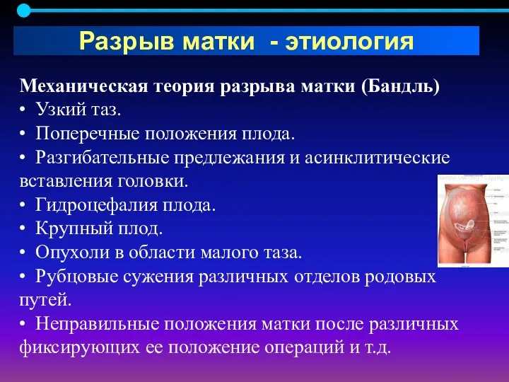 Механическая теория разрыва матки (Бандль) • Узкий таз. • Поперечные положения плода.