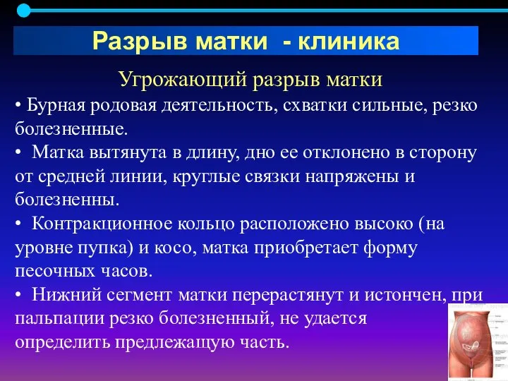 Угрожающий разрыв матки • Бурная родовая деятельность, схватки сильные, резко болезненные. •