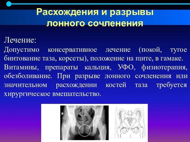 Лечение: Допустимо консервативное лечение (покой, тугое бинтование таза, корсеты), положение на щите,